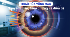Khám phá về thoái hóa võng mạc: Nguyên nhân, triệu chứng và điều trị hiệu quả