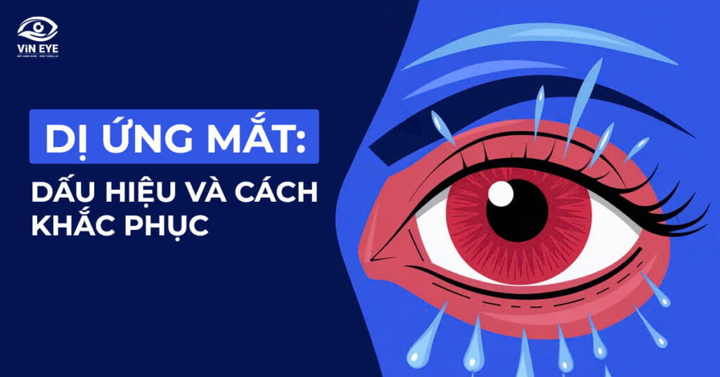 Dấu hiệu của dị ứng mắt và cách khắc phục