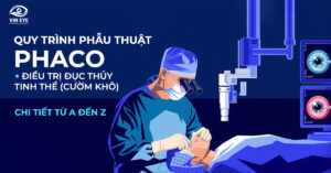 Quy trình phẫu thuật Phaco điều trị đục thủy tinh thể (cườm khô)