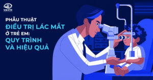 Quy trình và hiệu quả của phẫu thuật điều trị lác mắt ở trẻ em