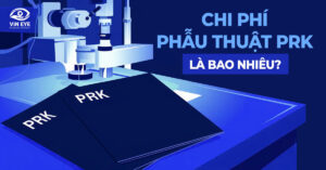 Phẫu thuật PRK: chi phí và các yếu tố ảnh hưởng