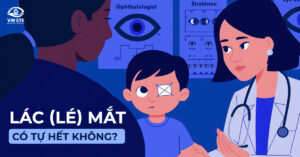 Giải đáp các câu hỏi xoay quanh bệnh mắt lác