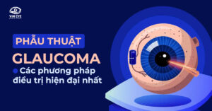 Phẫu thuật Glaucoma: Các phương pháp điều trị hiện đại nhất