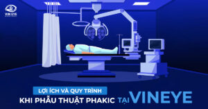 Phẫu thuật Phakic tại Bệnh viện Mắt VinEye: Lợi ích và Quy trình