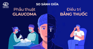 So sánh giữa phẫu thuật Glaucoma và điều trị bằng thuốc