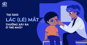 Nguyên nhân và biện pháp phòng ngừa lác mắt ở trẻ nhỏ