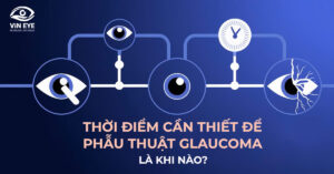 Phẫu thuật Glaucoma: Khi nào là thời điểm cần thiết?