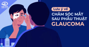 Lưu ý về chăm sóc mắt sau phẫu thuật Glaucoma