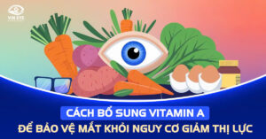 Cách bổ sung vitamin A để bảo vệ mắt khỏi nguy cơ suy giảm thị lực