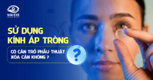 Sử dụng kính áp tròng: Có cản trở phẫu thuật mắt không?